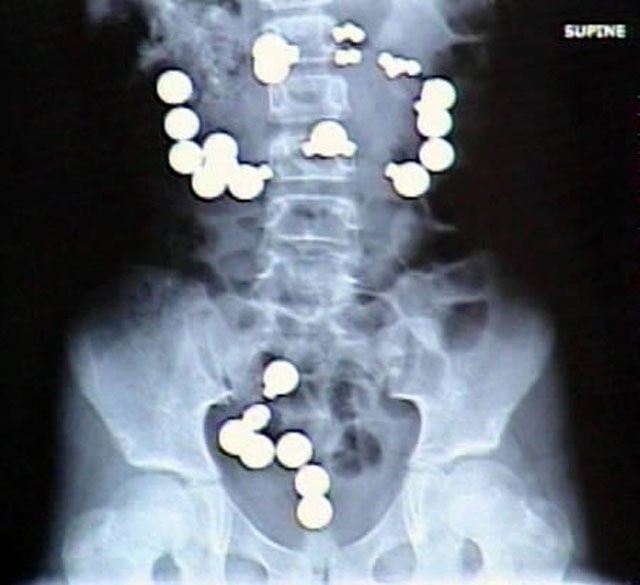 Real X-Rays That Will Shock and Astound You