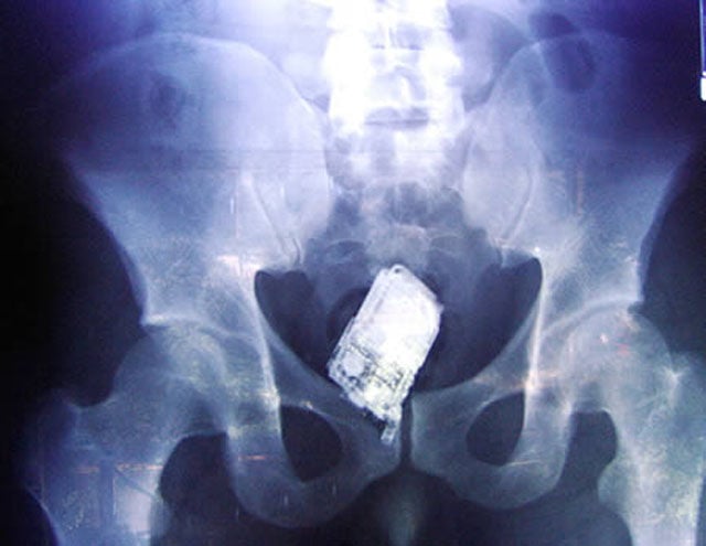 Real X-Rays That Will Shock and Astound You