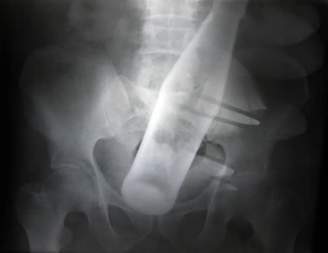 Real X-Rays That Will Shock and Astound You
