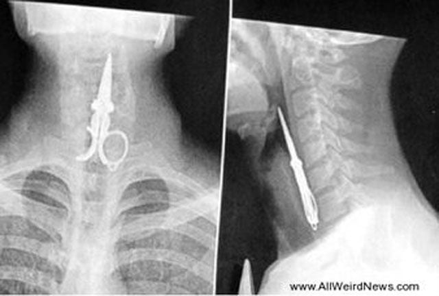 Real X-Rays That Will Shock and Astound You