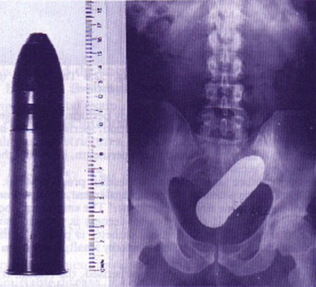 X-Rays That Prove That Horny Guys Are Idiots