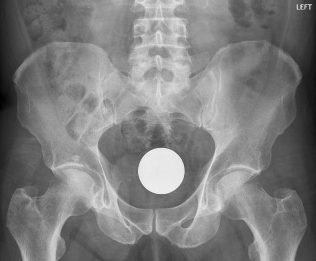 X-Rays That Prove That Horny Guys Are Idiots