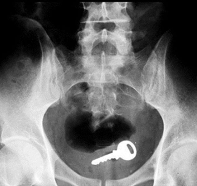 X-Rays That Prove That Horny Guys Are Idiots