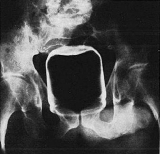 X-Rays That Prove That Horny Guys Are Idiots
