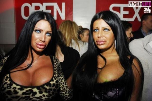 Queens of Disastrous Plastic Surgeries