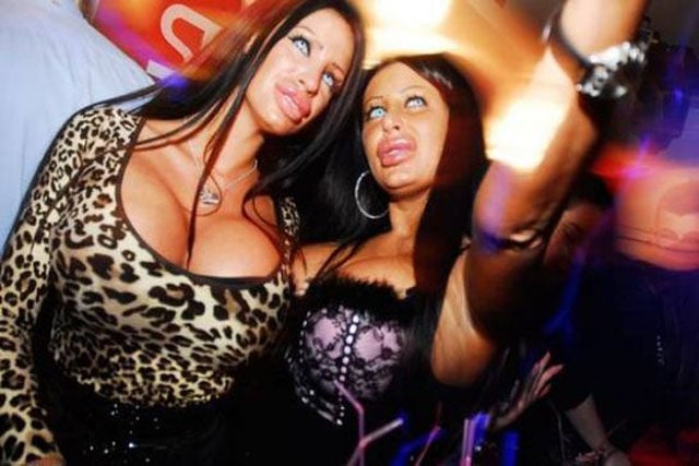 Queens of Disastrous Plastic Surgeries