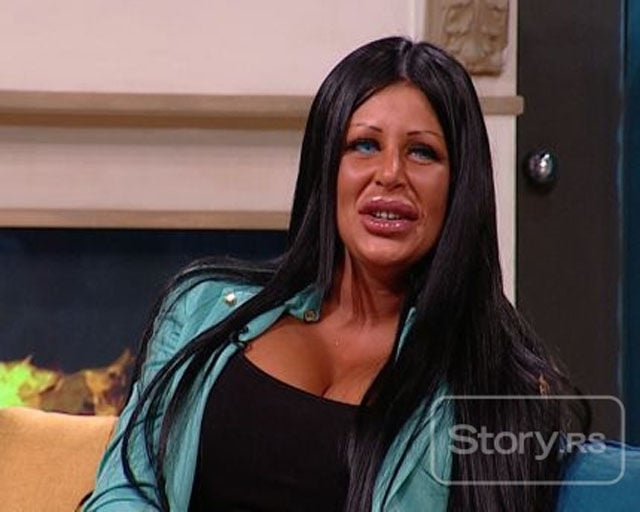 Queens of Disastrous Plastic Surgeries