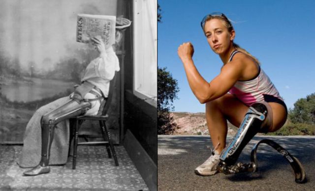The Incredible Progression of Medical Technology over Time