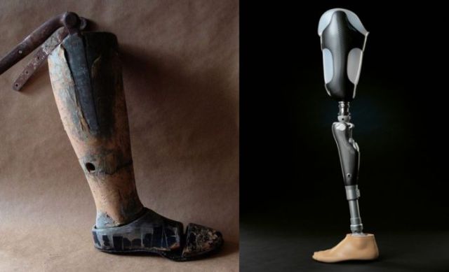 The Incredible Progression of Medical Technology over Time