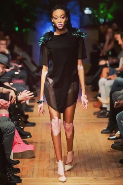 The Top Model without Stereotypical Good Looks