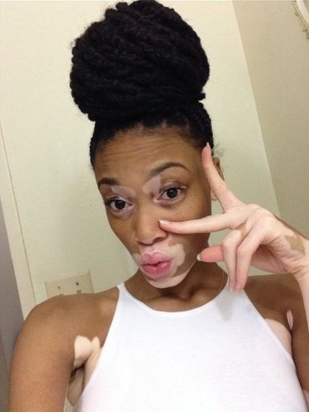 The Top Model without Stereotypical Good Looks