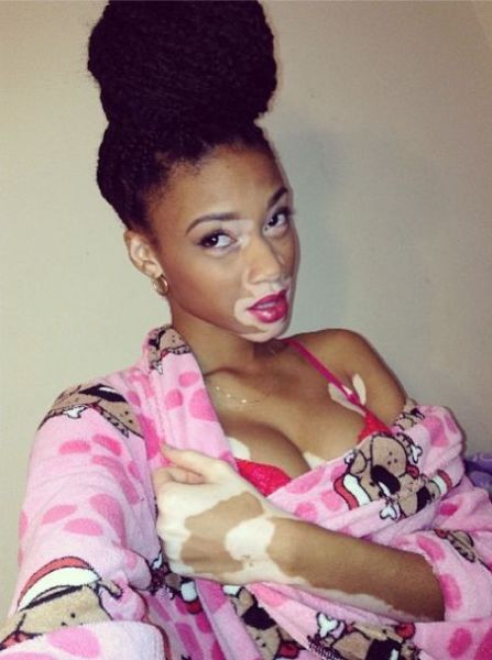 The Top Model without Stereotypical Good Looks