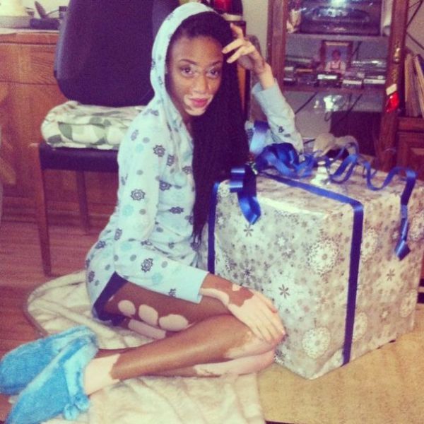 The Top Model without Stereotypical Good Looks