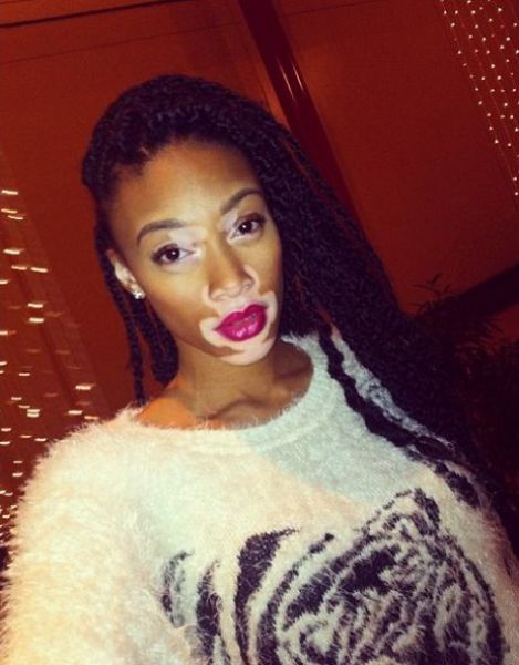 The Top Model without Stereotypical Good Looks