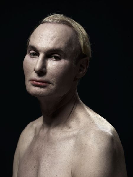 Plastic Surgery Fails That Are Just Wrong