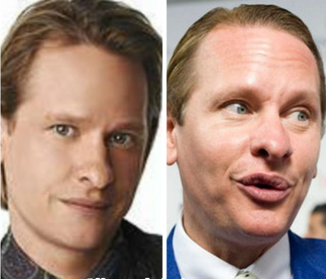 Plastic Surgery Fails That Are Just Wrong