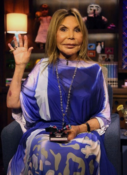 Plastic Surgery Fails That Are Just Wrong