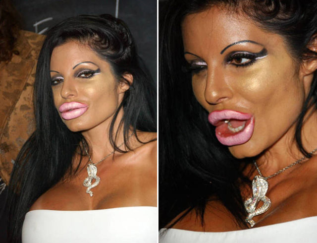 Plastic Surgery Fails That Are Just Wrong