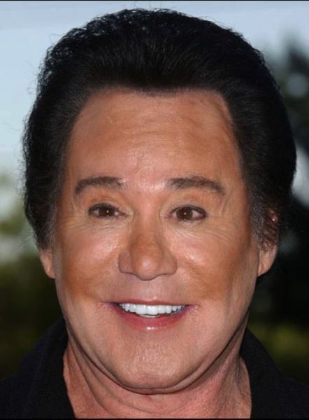 Plastic Surgery Fails That Are Just Wrong