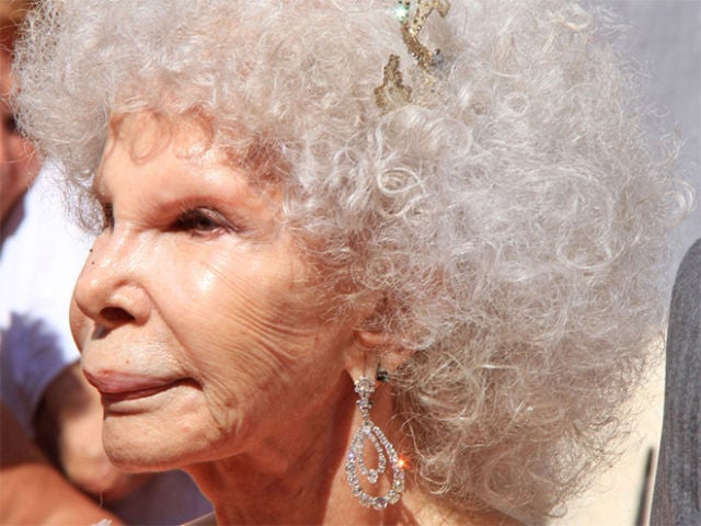 Plastic Surgery Fails That Are Just Wrong