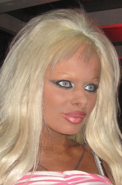 Plastic Surgery Fails That Are Just Wrong