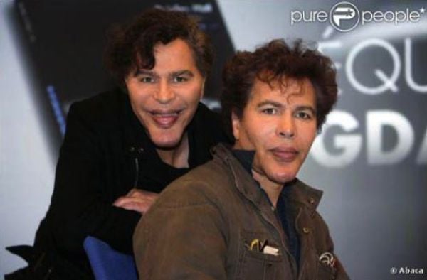 Plastic Surgery Fails That Are Just Wrong