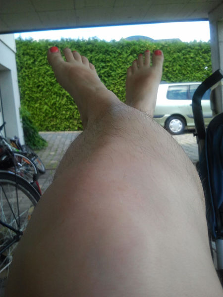 Woman Unite in Honor of Their Hairy Legs