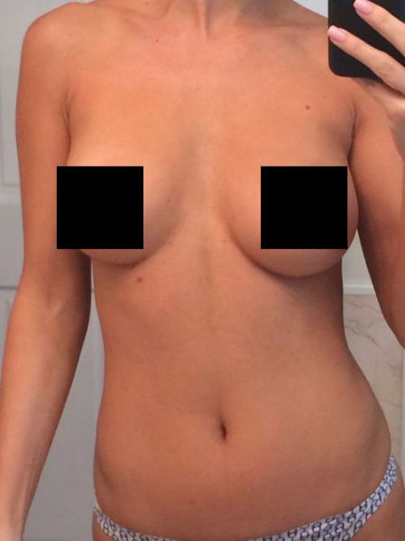 More Celebs Fall Victim to “The Fappening” with Leaked Photos