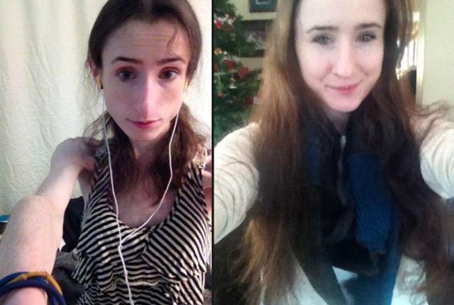 A Drastic Eating Disorder Recovery That Is Truly Amazing