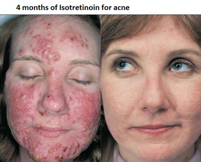 morning picdump 50 pics 14.html - 50 HD Photos | Premium Gallery 2015