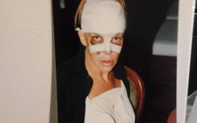 This Transgender Woman Has Taken Surgery Way Too Far