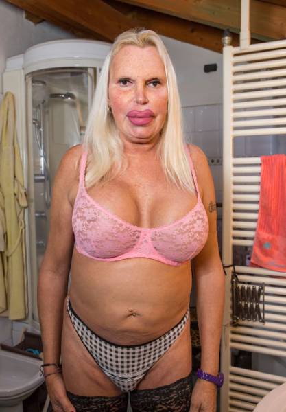 This Transgender Woman Has Taken Surgery Way Too Far