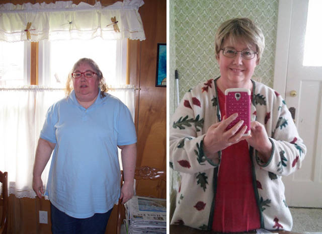 Weight Loss Success Stories