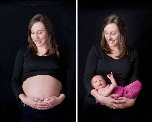Awesome Photos Before And After Giving Birth