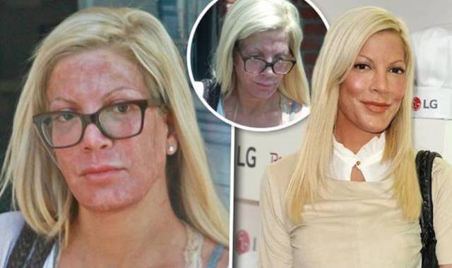 Celebrities Wish No One Saw These Embarrassing Pictures