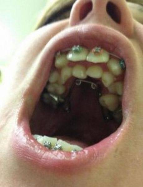 daily picdump 93 pics 25.html - 93 HD Photos | Premium Gallery 2016